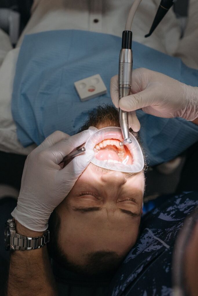 Close-up of a dental procedure with a patient's mouth open and cheek retractor in use.